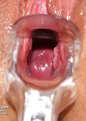 gyn clinic gyno 15 pics