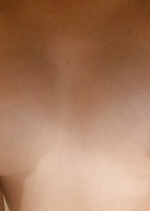    1 pics