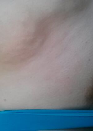    1 pics